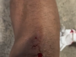 Teror ODGJ Jalan Raya Bikin Resah, Masyarakat Minta Penanganan Serius Dinas Terkait Sebelum Makan Korban Lagi